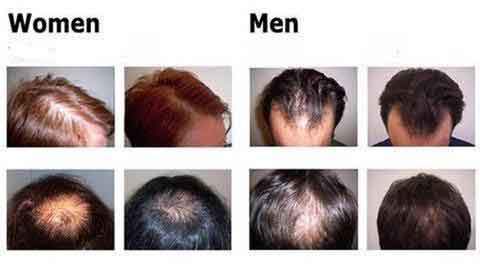 Biologische Essentie voor Haargroei